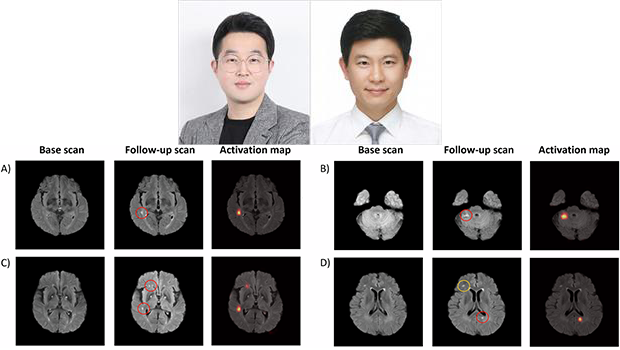 인천대 조환호 교수 연구팀, 한양대 구리병원 박성호 교수팀과 협력…‘무증상 뇌경색’ 자동  대표이미지
